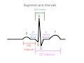 EKG Interpretation for Nurses Next-Gen NCLEX Prep Clinical Practice