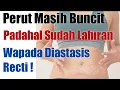 Download Lagu Perut Masih Terlihat Buncit (Besar) Padahal Sudah Tidak Hamil? Waspada DIASTASIS RECTI !