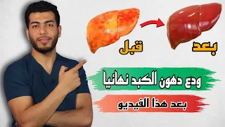 اسهل طريقه لازالة دهون الكبد وعلاج تشحم الكبد فى المنزل  دهون الكبد اعراضها وعلاجها ومدى خطورتها دندنها