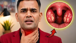 1 Simple Remedy Fix Throat Infection | Sore Throat & Swelling 