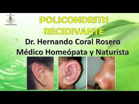 Download MP3 POLICONDRITIS RECIDIVANTE (ENFERMEDAS INFLAMATORIA EN CARTILAGOS)