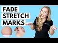 Fade Stretch Marks Ingredients that WORK and the Science to Back it up