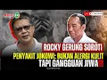 Download Lagu ROCKY GERUNG SOROTI PENYAKIT JOKOWI: BUKAN ALERGI KULIT TAPI GANGGUAN JIWA!!!