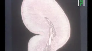 كيف يعمل هرمون الأدرينالين في البرد  دندنها