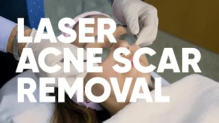 Treatment and benefits Treatment and benefits