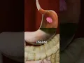 Channel