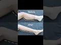 Download Lagu Slim legs workout | Legs exercise | Slim calves workout