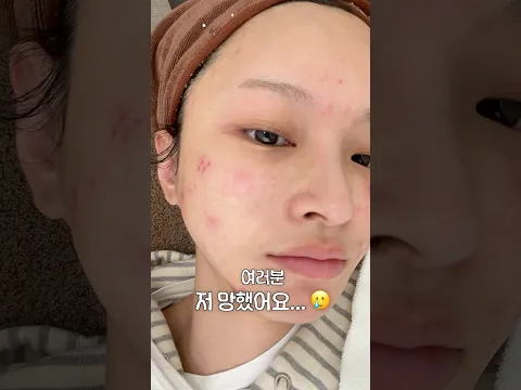 시술 후 돈 날리기 싫다면?🙅🏻‍♀️ 시술 후 흔적 애프터 케어💉