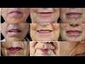 Angellift Reviews as seen on Shark Tank with several real customer before and afters