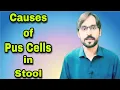 Pus Cells in Stool Causes of Pus Cells in Stool
