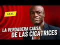 Que es el origen de las cicatrices faciales de Seal que celebro sus 61 anos
