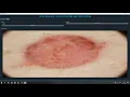SKIN DISEASE CLASSIFICATION PYTORCH GUI Machine Learning Deep Learning Python Project
