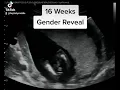 Gender Reveal Ultrasound at 16 Weeks Pregnant
