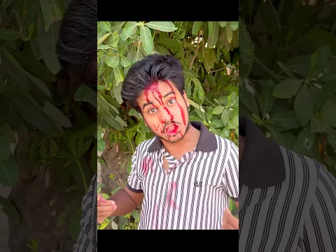 Humanity Test Doctor, 😰 #minivlog #vlog #humanity #doctor #accident ￼￼￼￼