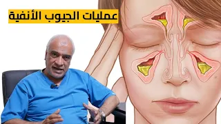 عمليات الجيوب الأنفية ومضاعفاتها دندنها