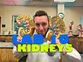 A P II - Lab 10 Urinary System Lab Review