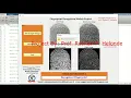 Fingerprint Recognition Using Image Processing With Source Code Fingerprint Detection Matlab Code