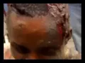 Download Lagu CONGO MOTO EPELI BA PANZI MUTU LOKOLA NIAMA
