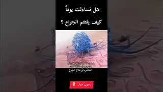 هكذا يلتئم الجرح هل تساءلت يوما كيف يلتئم الجرح Shorts 