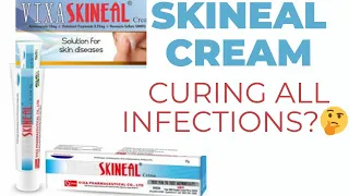 Can Skineal Treat All Skin Infections #skincare #skineal #skinealreview #creamreview #productreview