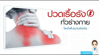  วิธีรักษาไฟโบรมัยอัลเจียมีอะไรบ้าง และควรปรับพฤติกรรมอย่างไร 