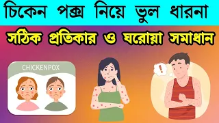 জল বসন্তের ভুল ধারণা ও প্রতিকারের উপায় | Misconceptions about chickenpox