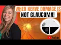When Optic Nerve Damage is NOT Glaucoma Clinic PowerUp