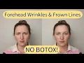 Forehead Massage for Wrinkles Frown Lines Massage Tutorial That Works