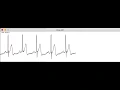 ECG plotter