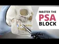 HOW TO DO A POSTERIOR SUPERIOR ALVEOLAR PSA NERVE BLOCK OnlineExodontia com