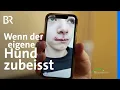 Lagu Wenn das eigene Haustier beisst: Gefährliche Infektionen drohen | Gesundheit | BR