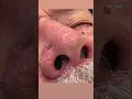 Denver Men s waxing