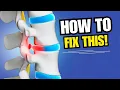 How to Help Your Herniated Disc Heal Quicker Disc Herniation Taping