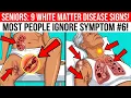 OVER 60 8 Huntington s Disease Early Signs Most People Miss
