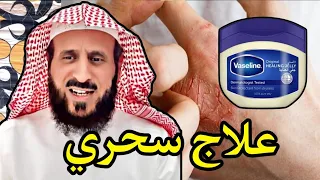 الشيخ فهد القرني رقية لحل الاكزيما من خلال الفازلين 