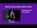 Vscan Air Using presets for evaluations cardiac function
