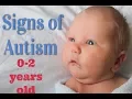 Signs of Autism in infants