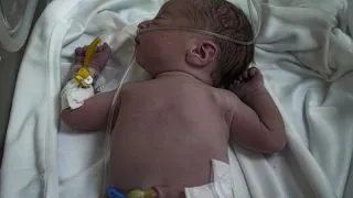 يسمع ضجيج القنابل قبل صوت أمه عن طفل رضيع في مستشفيات غزة 