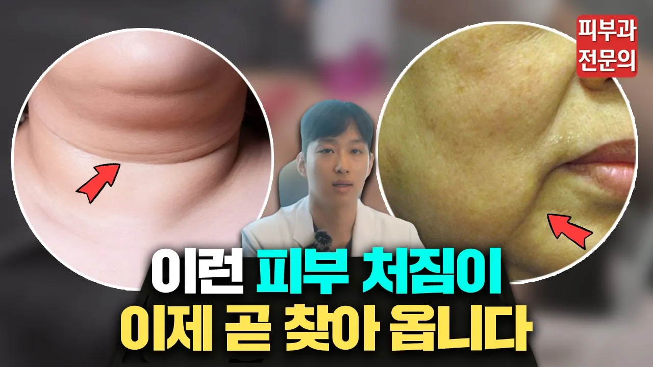 피부과 전문의가 알려주는 피부 탄력 관리(울쎄라) 200% 효과 보는 방법