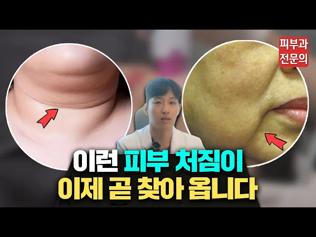 피부과 전문의가 알려주는 피부 탄력 관리(울쎄라) 200% 효과 보는 방법