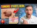 99 OF TUMORS START LONG BEFORE THE LUMP THE CELL SIGN YOU IGNORE