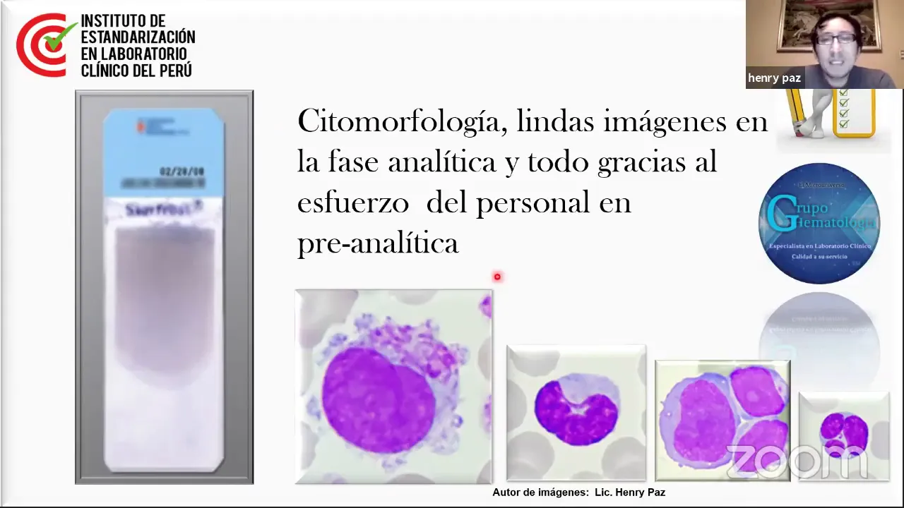 Pre analítica en Hematología