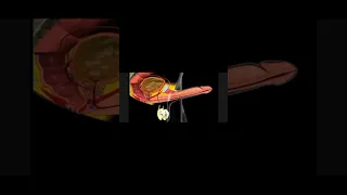 عملية انتصاب القضيب لممارسة الجنس 