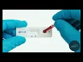 HOW TO Use an HIV Self-Test Kit at Home Finger Prick Tutorial