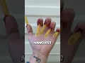 Download Lagu Cutting Off an Extra Finger?! 🔪 (@sfxbydavid on TikTok) #shorts