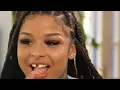 23 Chrisean Rock shows us her tooth getting fixed