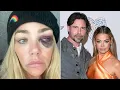 Denise Richards Accuses Ex of Leaking Nudes and Breaking Court Order