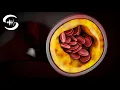 Download Lagu Verlaag het cholesterol op natuurlijke wijze - verlaag het cholesterolgehalte