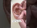 Reduce shoulder pain by massaging your ear