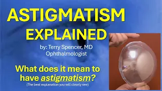 Astigmatism Explained